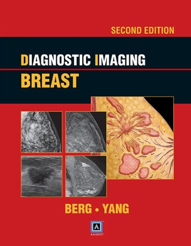 Diagnostic Imaging:Breast 2/e