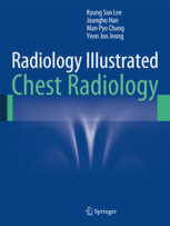 Radiology Illustrated : Chest Radiology