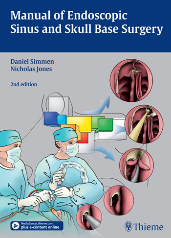 Manual of Endoscopic Sinus and Skull Base Surgery 2/e