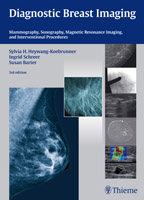 Diagnostic Breast Imaging : Mammography Ultrasound MRI Intervention Procedures
