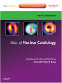 Atlas of Nuclear Cardiology: Imaging Companion to Braunwald's Heart Disease