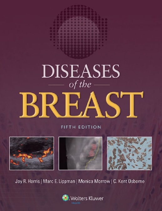 Diseases of the Breast-5판