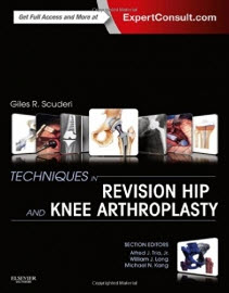 Techniques in Revision Hip and Knee Arthroplasty