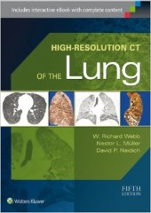 High-Resolution CT of the Lung 5/e