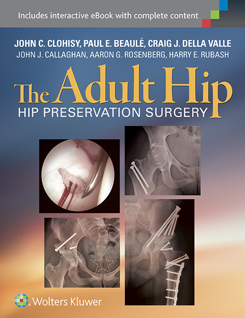 The Adult Hip 3/e