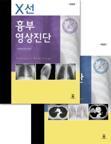 흉부영상진단X선+흉부영상진단CT[2권세트]