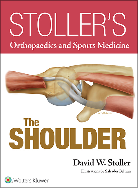Stoller`s Orthopaedics and Sports Medicine: The Shoulder-1판