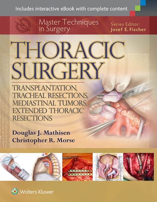 Master Techniques in Surgery: Thoracic Surgery: Transplantation Tracheal Resections Mediastinal Tumors Extended Thoracic Resections