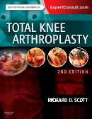 Total Knee Arthroplasty 2/e