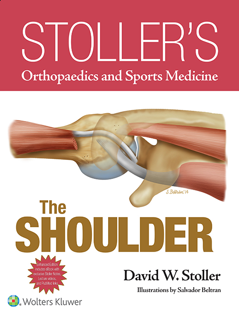 Stoller's Orthopaedics and Sports Medicine: The Shoulder (Print + eBook bundle)