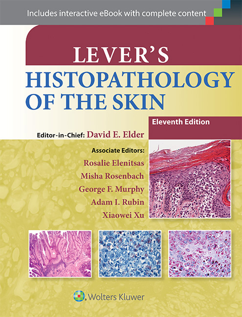 Lever's Histopathology of the Skin 11/e