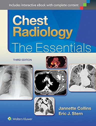 Chest Radiology: The Essentials 3/e