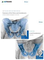 Fractures of the Pelvis and Acetabulum: Principles and Methods of Management-4판