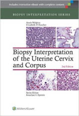 Biopsy Interpretation of the Uterine Cervix and Corpus (Biopsy Interpretation Series)-2판(2015.02)