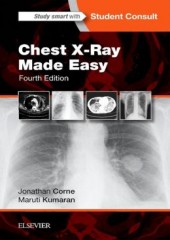 Chest X-Ray Made Easy 4/e