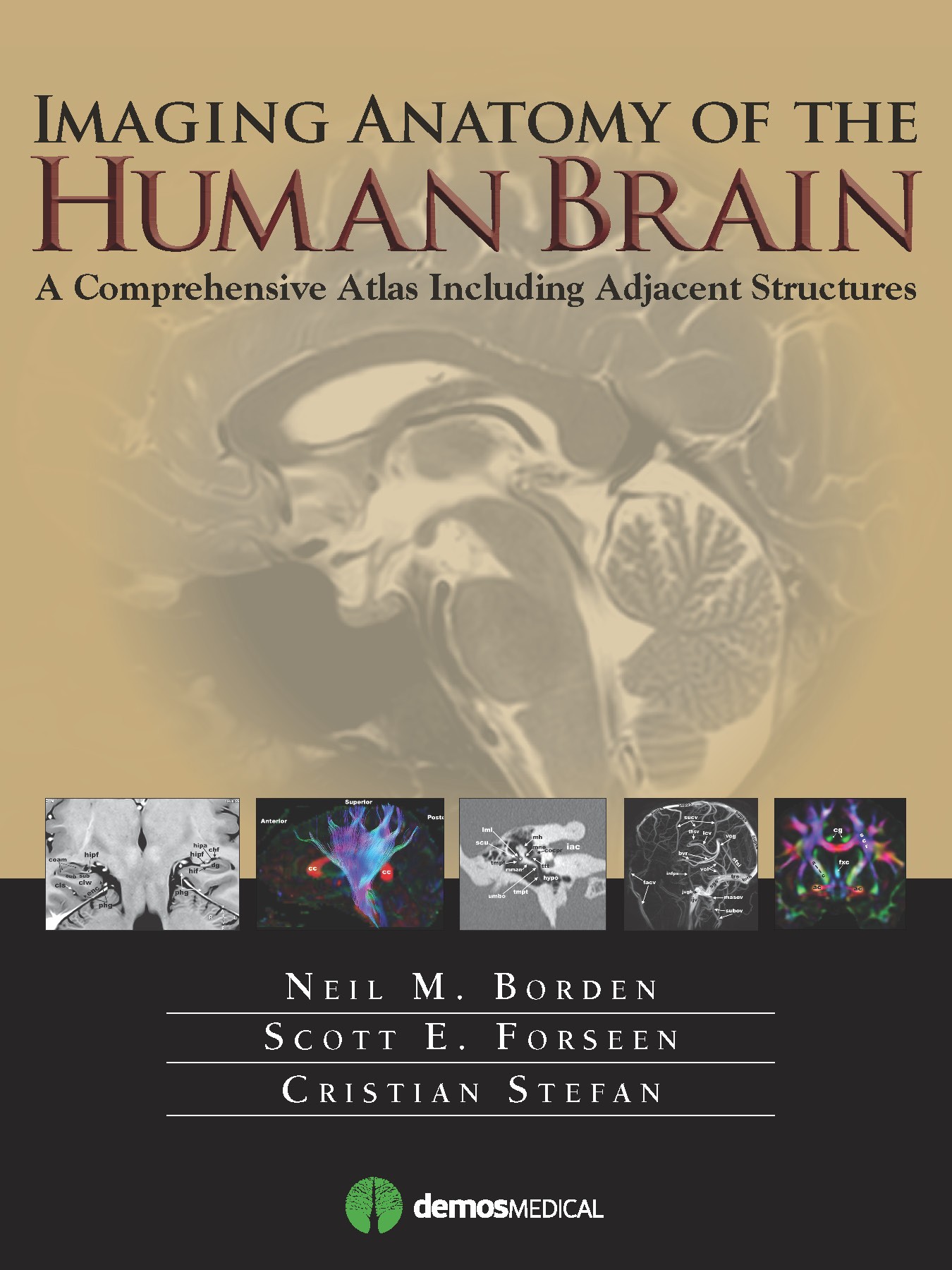 Multimodality Atlas of the Human Brain (Hardcover)