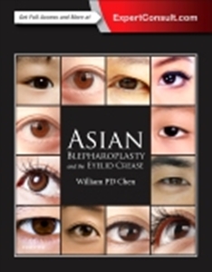 Asian Blepharoplasty and the Eyelid Crease 3/e