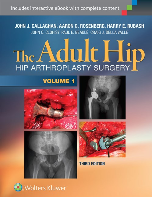 The Adult Hip 2vols-3판(2015.10)