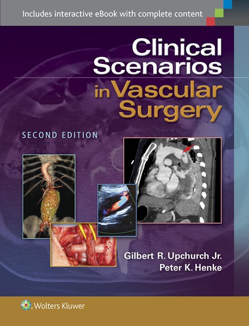 Clinical Scenarios in Vascular Surgery 2/e