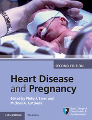 Heart Disease and Pregnancy (Hardback)-2판