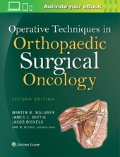 Operative Techniques in Orthopaedic Surgical Oncology-2판(2016.02)