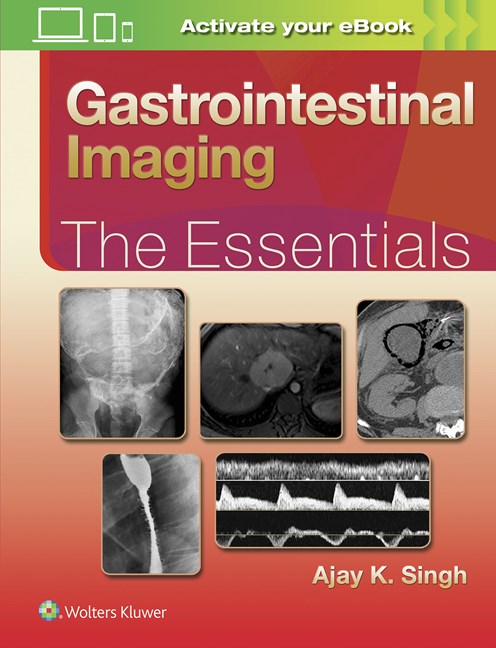 Gastrointestinal Imaging: The Essentials-1판