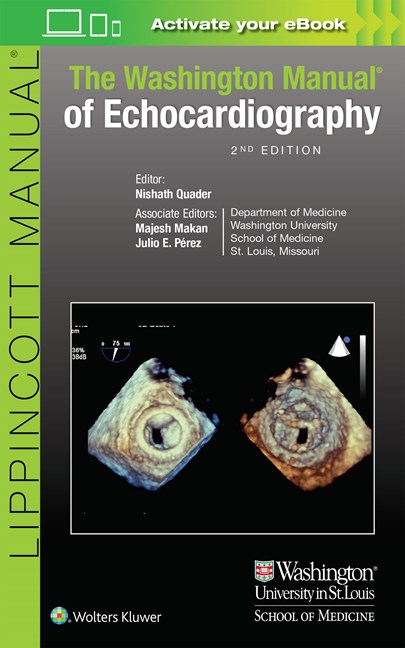 The Washington Manual of Echocardiography-2판