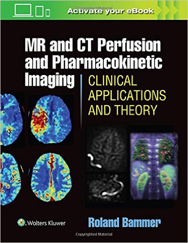 MR and CT Perfusion and Pharmacokinetic Imaging-1판