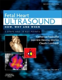 Fetal Heart Ultrasound-2판