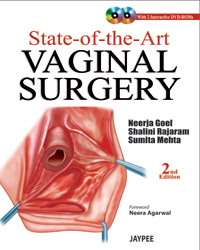 State of the Art Vaginal Surgery 2/e(With DVD Rom)