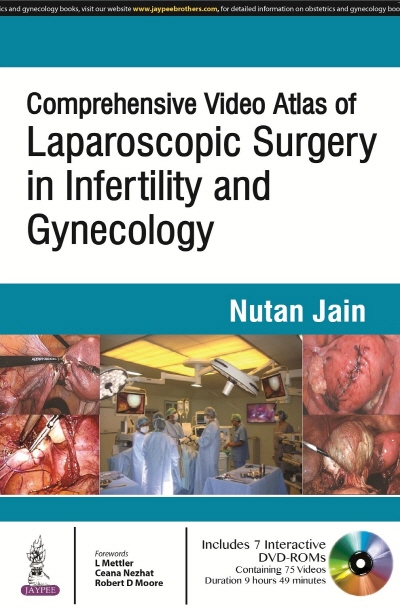 Comprehensive Video Atlas of Laparoscopic Surgery in Infertility and Gynecology