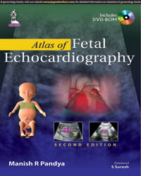 Atlas of Fetal Echocardiography-2판