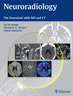 Neuroradiology; The Essentials With MR and CT