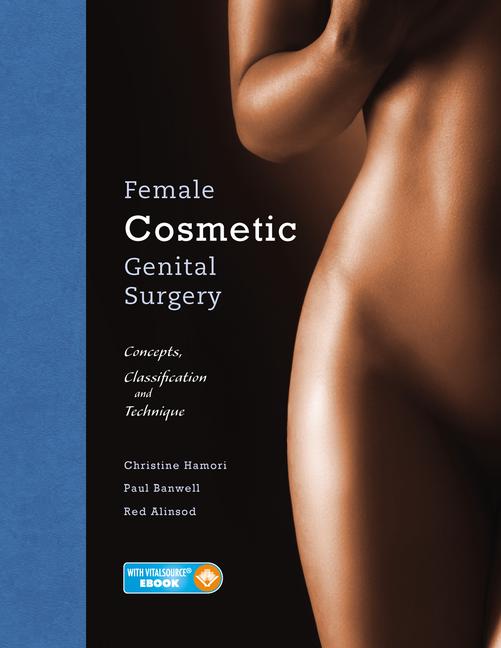 Female Cosmetic Genital Surgery-1판
