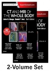 CT and MRI of the Whole Body-6판 2Vols