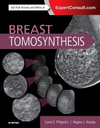 Breast Tomosynthesis-1판