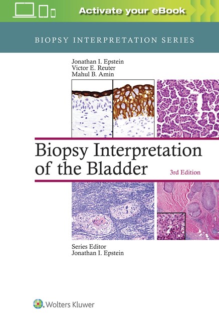 Biopsy Interpretation of the Bladder-3판(2016.08)