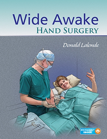 Wide Awake Hand Surgery-1판