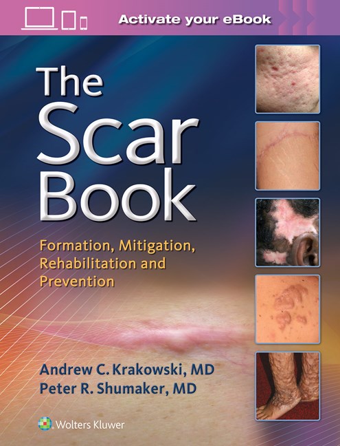 The Scar Book-Scar Formation Rehabilitation and Prevention