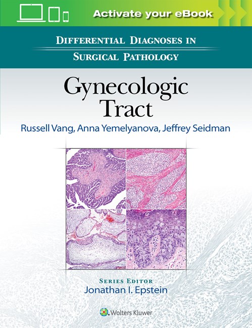 Differential Diagnoses in Surgical Pathology: Gynecologic Tract-1판