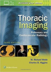 Thoracic Imaging-3판