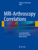 MRI-Arthroscopy Correlations(A Case-Based Atlas of the Knee Shoulder Elbow and Hip)