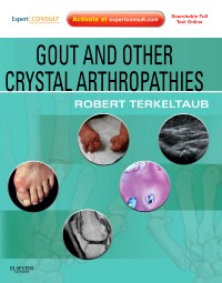 Gout and Other Crystal Arthropathies - Expert Consult: Online and Print