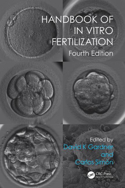 Handbook of In Vitro Fertilization-4판