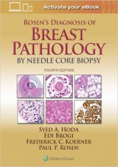 Rosen's Diagnosis of Breast Pathology by Needle Core Biopsy-4판