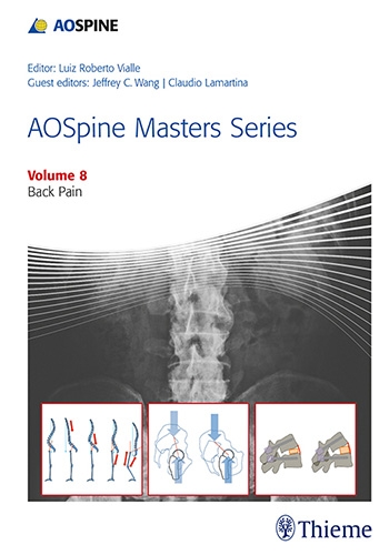 AOSpine Masters Series Volume 8: Back Pain