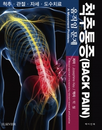 척추통증 - 움직임 문제