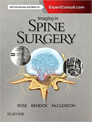 Imaging in Spine Surgery 1e