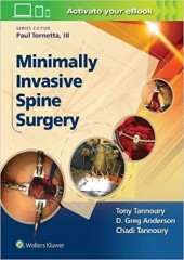 Minimally Invasive Spine Surgery-1판