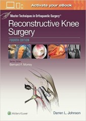 Master Techniques in Orthopaedic Surgery: Reconstructive Knee Surgery-4판